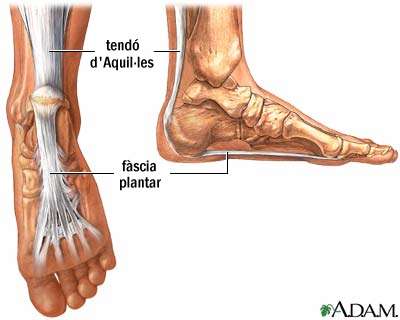 Fascitis plantar: una de les lesions m�s comuns entre els corredors | EbreActiu.cat, revista digital d&rsquo;oci actiu | Terres de l&rsquo;Ebre ...